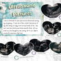 Ultrasound